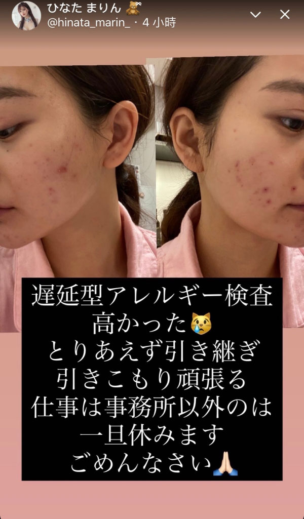 不化妆不行!ひなたまりん的脸坏掉了!-1 不化妆不行!ひなたまりん的脸坏掉了!